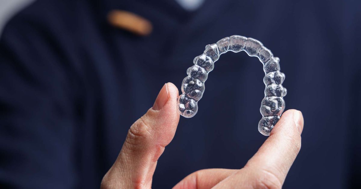Caso studio: terapia ortodontica invisibile