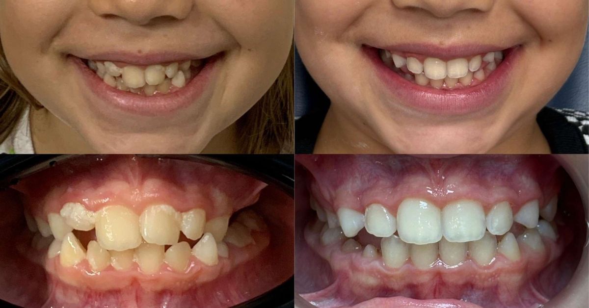 Come si fa diagnosi di malattia parodontale?